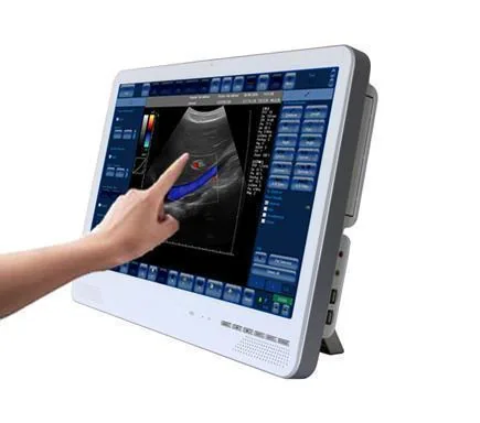 SONOSTAR C6 ultrasound machine
