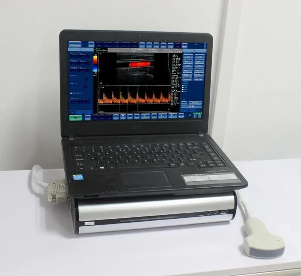 SONOSTAR CBox-3 ultrasound machine