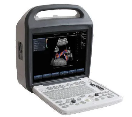 SONOSTAR SS-1000 ultrasound machine