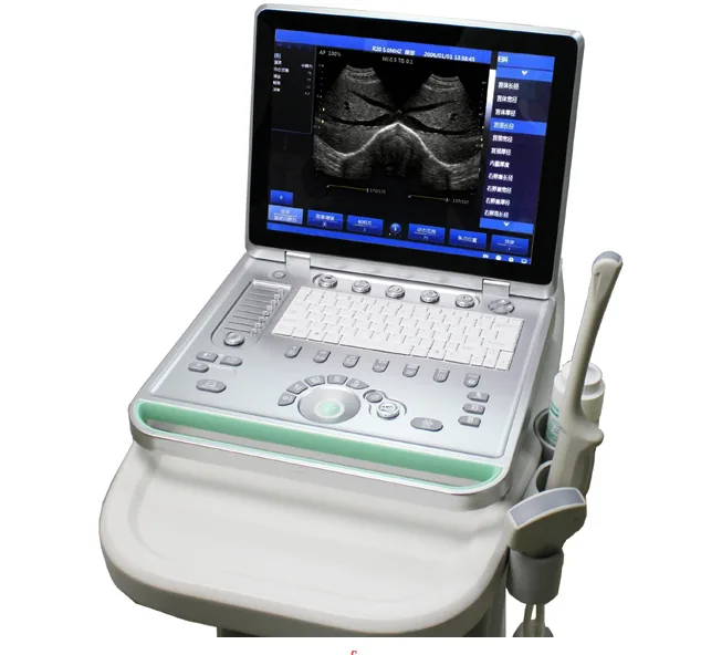 SONOSTAR SS-8 ultrasound machine