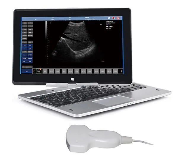 SONOSTAR UBook-8 ultrasound machine