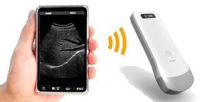 SONOSTAR UProbe-2 ultrasound machine