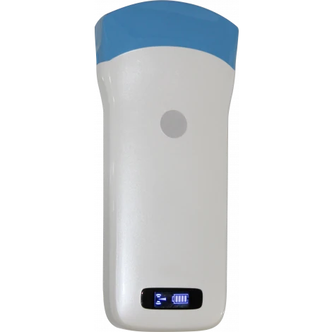 SONOSTAR UProbe-C5 ultrasound machine
