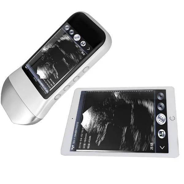 SONOSTAR XProbe-5N ultrasound machine