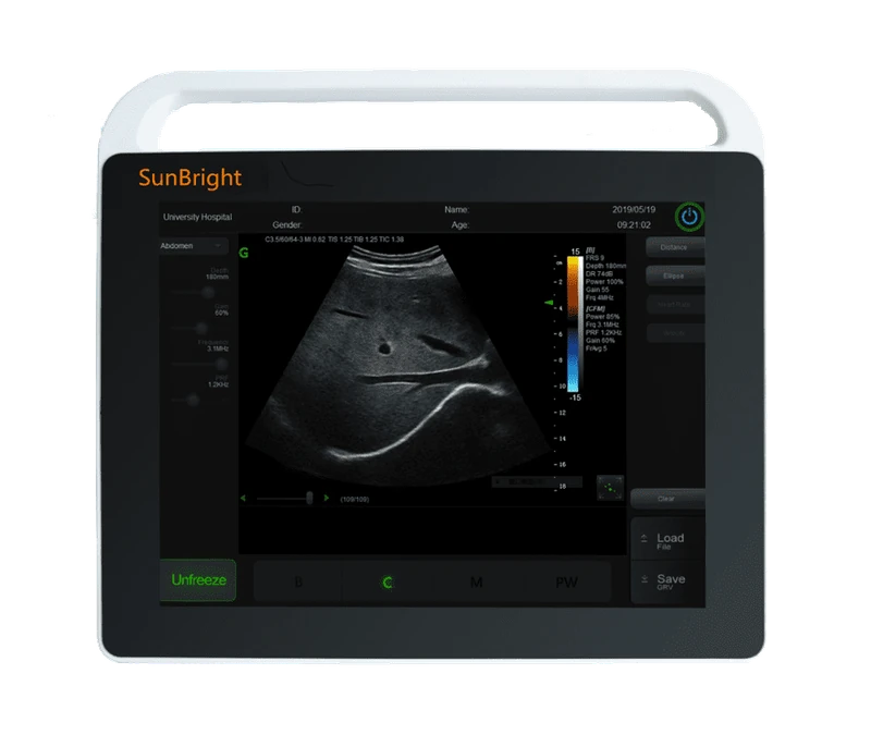 SUNBRIGHT SUN-800S ultrasound machine