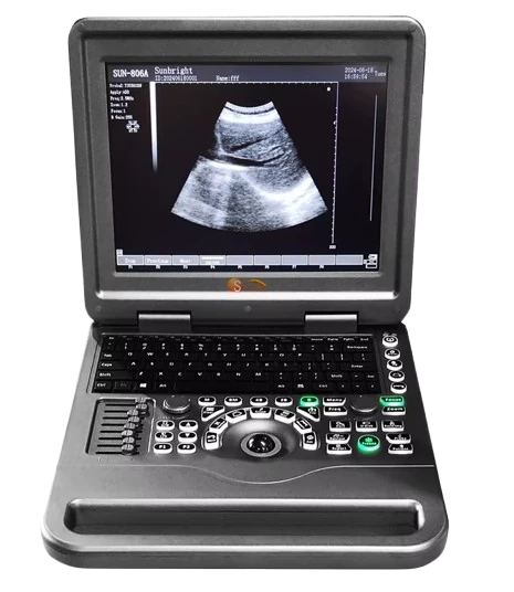 SUNBRIGHT SUN-806A ultrasound machine