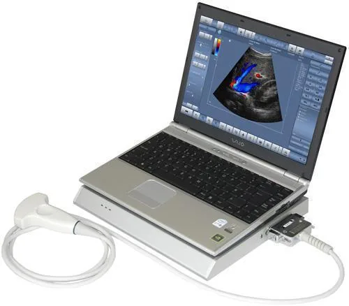 TELEMED LogicScan 64 ultrasound machine