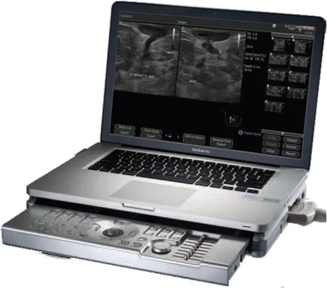 TERASON t3200 ultrasound machine