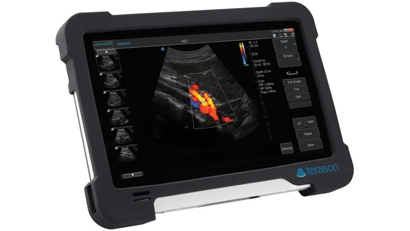 TERASON uSmart 3200T ultrasound machine