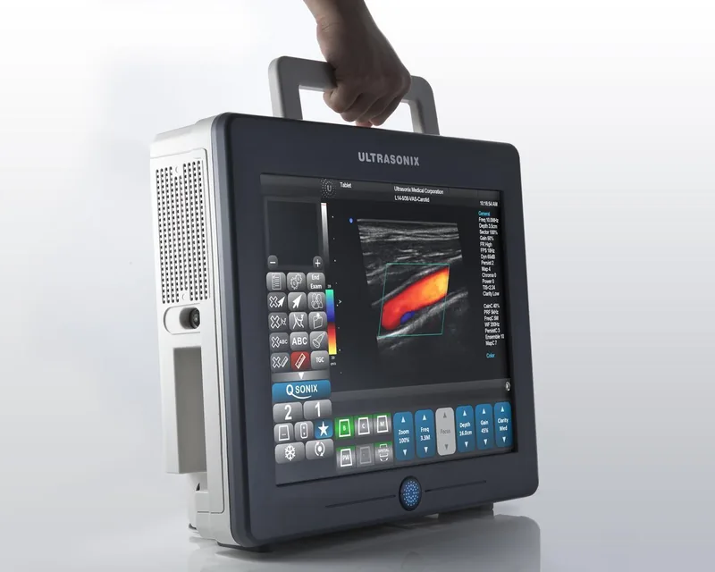 ULTRASONIX Sonix Tablet ultrasound machine