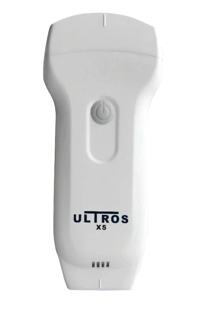 ULTROS X5 ultrasound machine