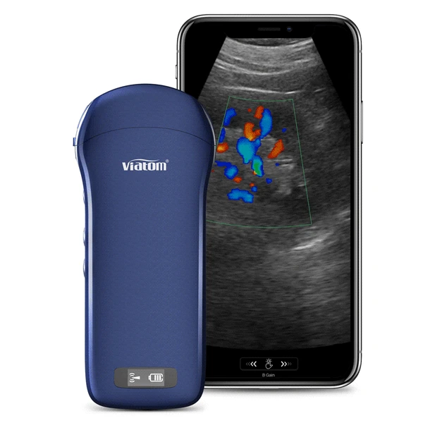 VIATOM 3 in 1 ultrasound machine