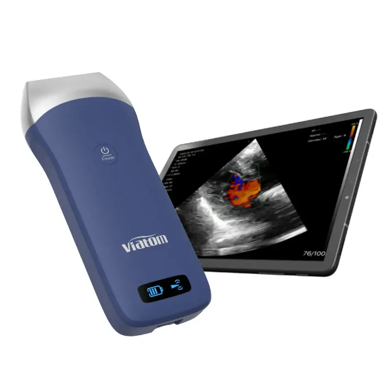 VIATOM Linear-Head ultrasound machine