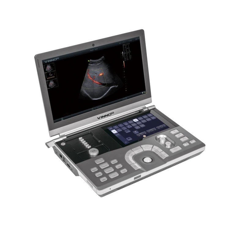 VINNO 10 ultrasound machine