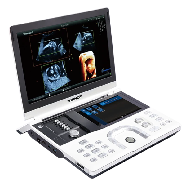 VINNO 8 ultrasound machine
