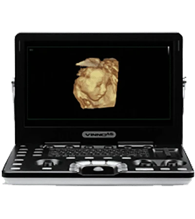 VINNO A6 ultrasound machine