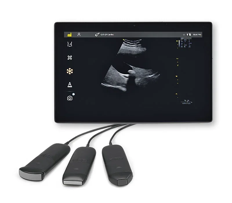 VINNO Q SERIES ultrasound machine