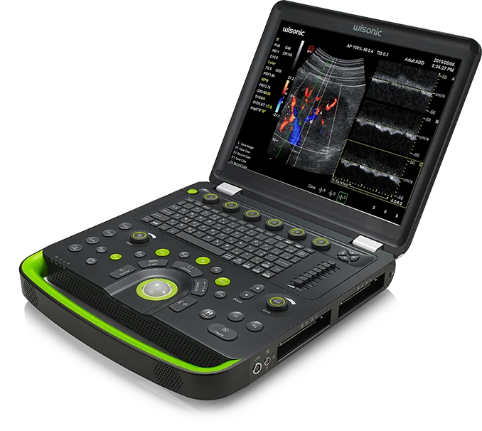 WISONIC Clover 60 ultrasound machine