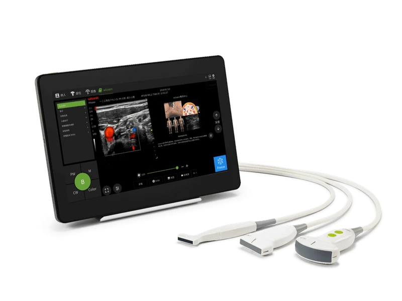 WISONIC Piloter S ultrasound machine