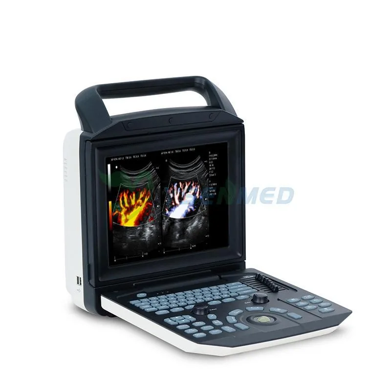 YUESHEN MEDICAL YSB-M5 ultrasound machine