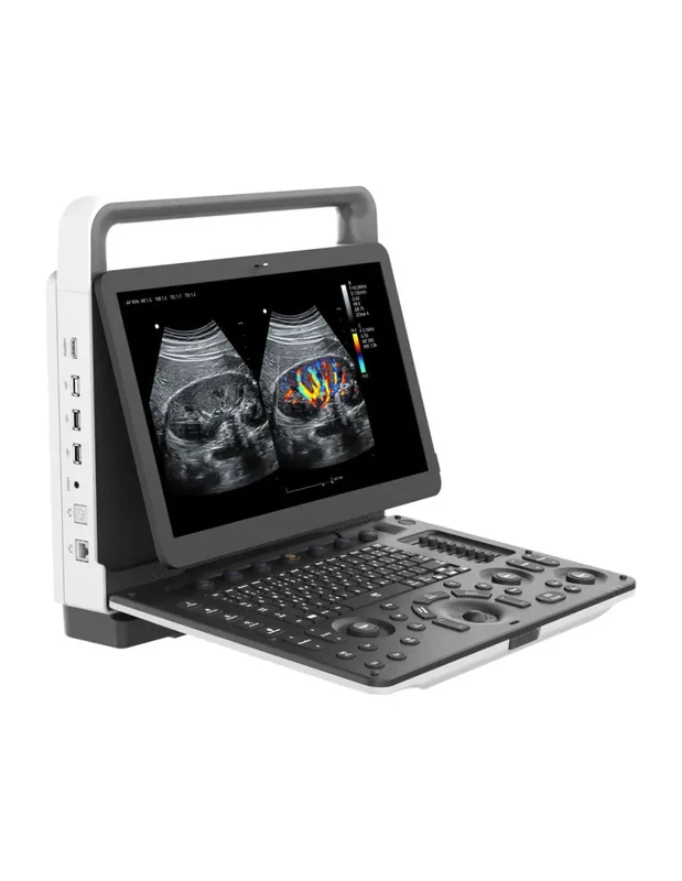 ZONCARE M30 ultrasound machine
