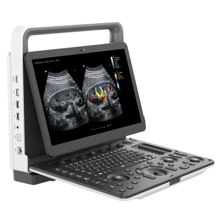 ZONCARE M70 ultrasound machine