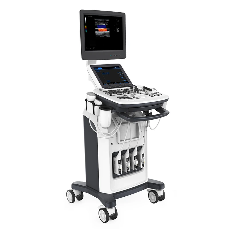 ZONCARE P7 ultrasound machine