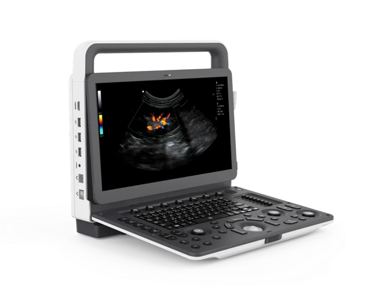 ZONCARE VU2EXP ultrasound machine