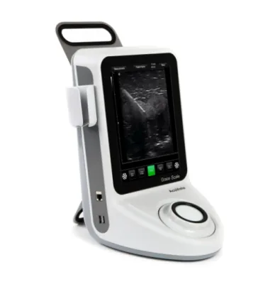 ACUVISTA Grace Scale ultrasound machine