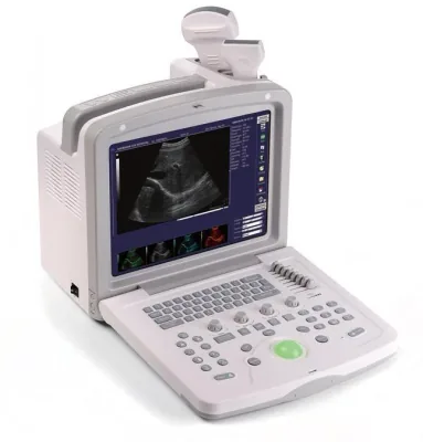 ACUVISTA RS880d ultrasound machine