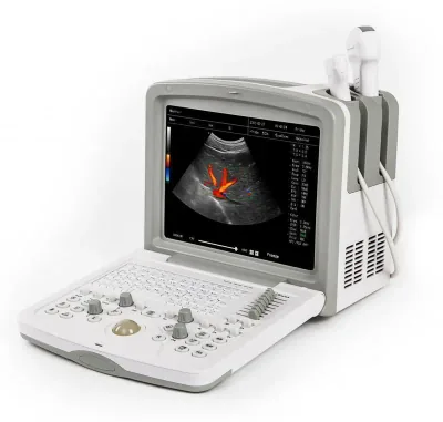 ACUVISTA RS880i ultrasound machine