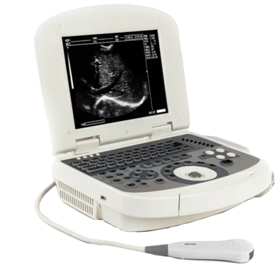 ACUVISTA VT98C ultrasound machine