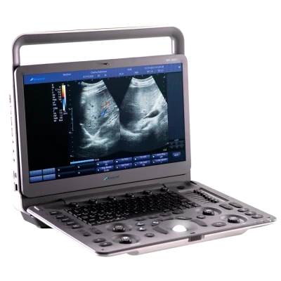 ADVANCED INSTRUMENTATIONS DUS-5000 + ultrasound machine