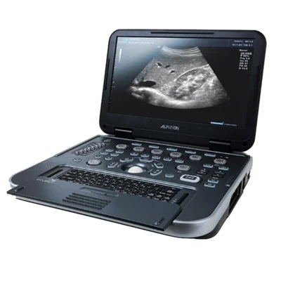 ALPINION E-CUBE i7 ultrasound machine