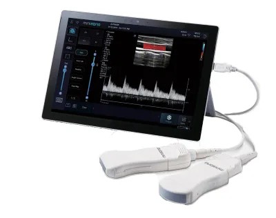 ALPINION MiniSono ultrasound machine