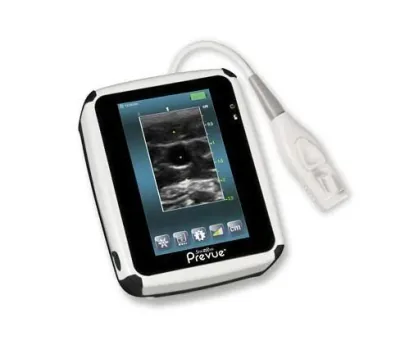 BARD Site-Rite Prevue ultrasound machine