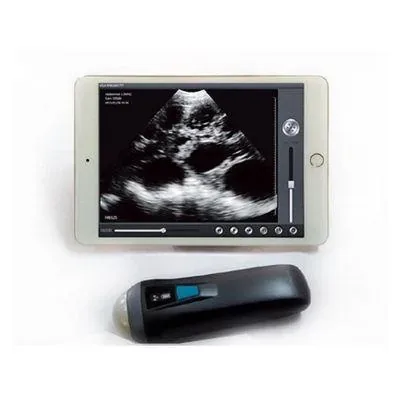 BETTER BSCAN-2 ultrasound machine
