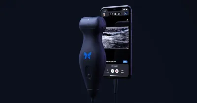BUTTERFLY NETWORK Butterfly iQ plus ultrasound machine