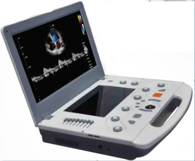 CANYEARN С95 ultrasound machine