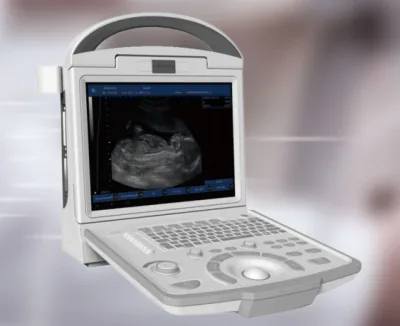 CANYEARN A65 ultrasound machine