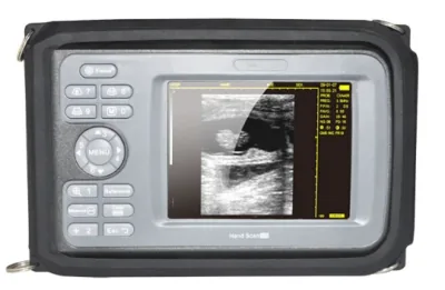 CAREJOY HandScan H8 ultrasound machine