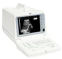 CHISON 600M ultrasound machine