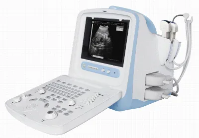 CHISON 8100 ultrasound machine