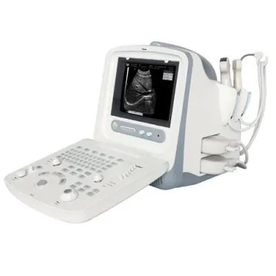 CHISON 8300 ultrasound machine