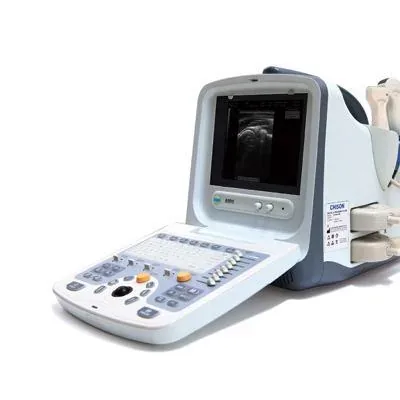 CHISON 9300 ultrasound machine