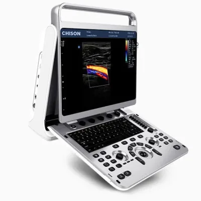 CHISON Ebit 20 ultrasound machine
