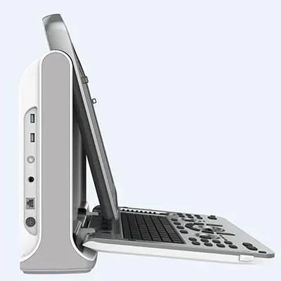 CHISON EBit 30 ultrasound machine