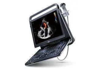 CHISON EBit 50 ultrasound machine