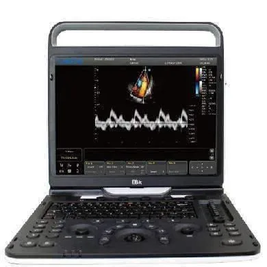 CHISON EBit 60 VET ultrasound machine