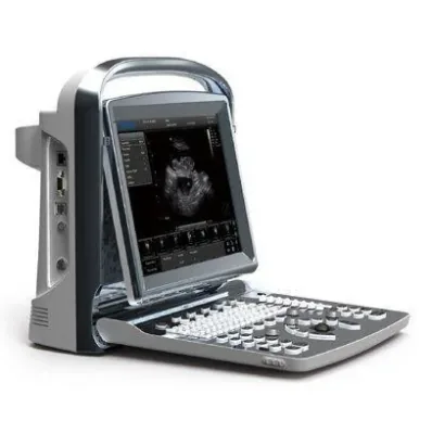 CHISON ECO 1 VET ultrasound machine